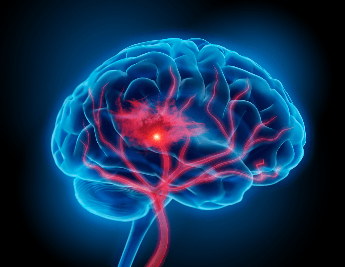 brain